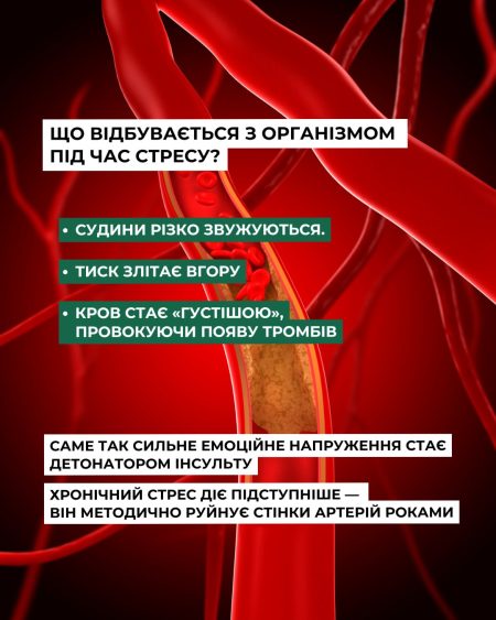 Ми часто не дооцінюємо стрес.Але саме він може стати пусковим механізмом інсульту у людей з факт (1) Ми часто не дооцінюємо стрес.Але саме він може стати пусковим механізмом інсульту у людей з факт (1)