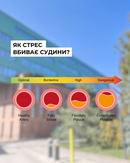 Ми часто не дооцінюємо стрес.Але саме він може стати пусковим механізмом інсульту у людей з факт Ми часто не дооцінюємо стрес.Але саме він може стати пусковим механізмом інсульту у людей з факт